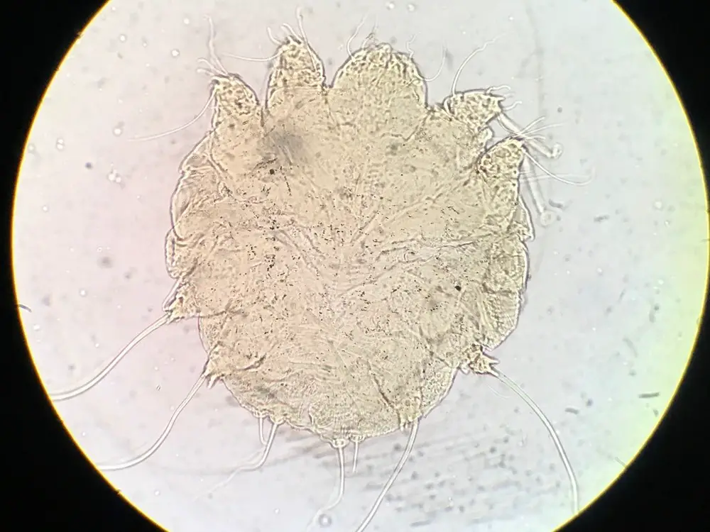 Scabies Images Under Microscope