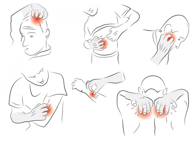 Rash Drawing Scabies Causes Symptoms Treatment Pictures Images Rash Drawing Scabies Causes Symptoms Treatment Pictures Images