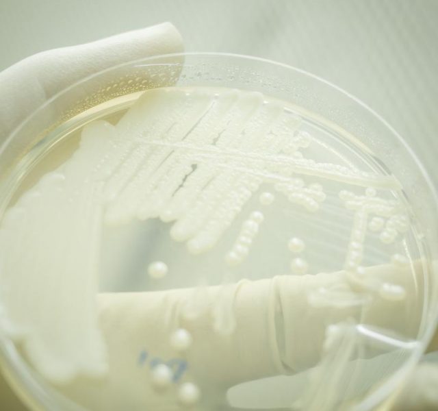 Close up of Yeast cultivation on agar medium plate in microbiology laboratory