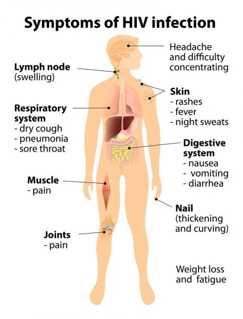 Symptoms of HIV infection