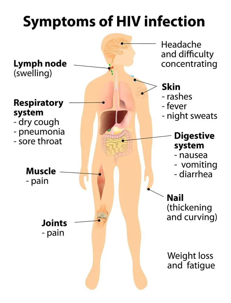 HIV AIDS Symptoms Treatment Testing STD HIV AIDS hiv-aids-symptoms-treatment-testing-std-hiv-aids