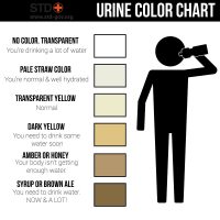 dark urine causes what does it mean what to do faqs
