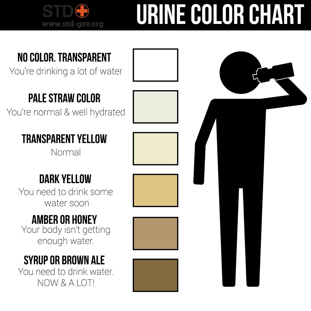 what causes dark urine